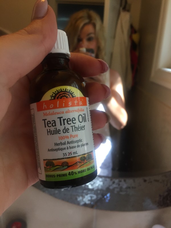 It’s Not Great For Your Love Life, But It’s Great For Zits! 