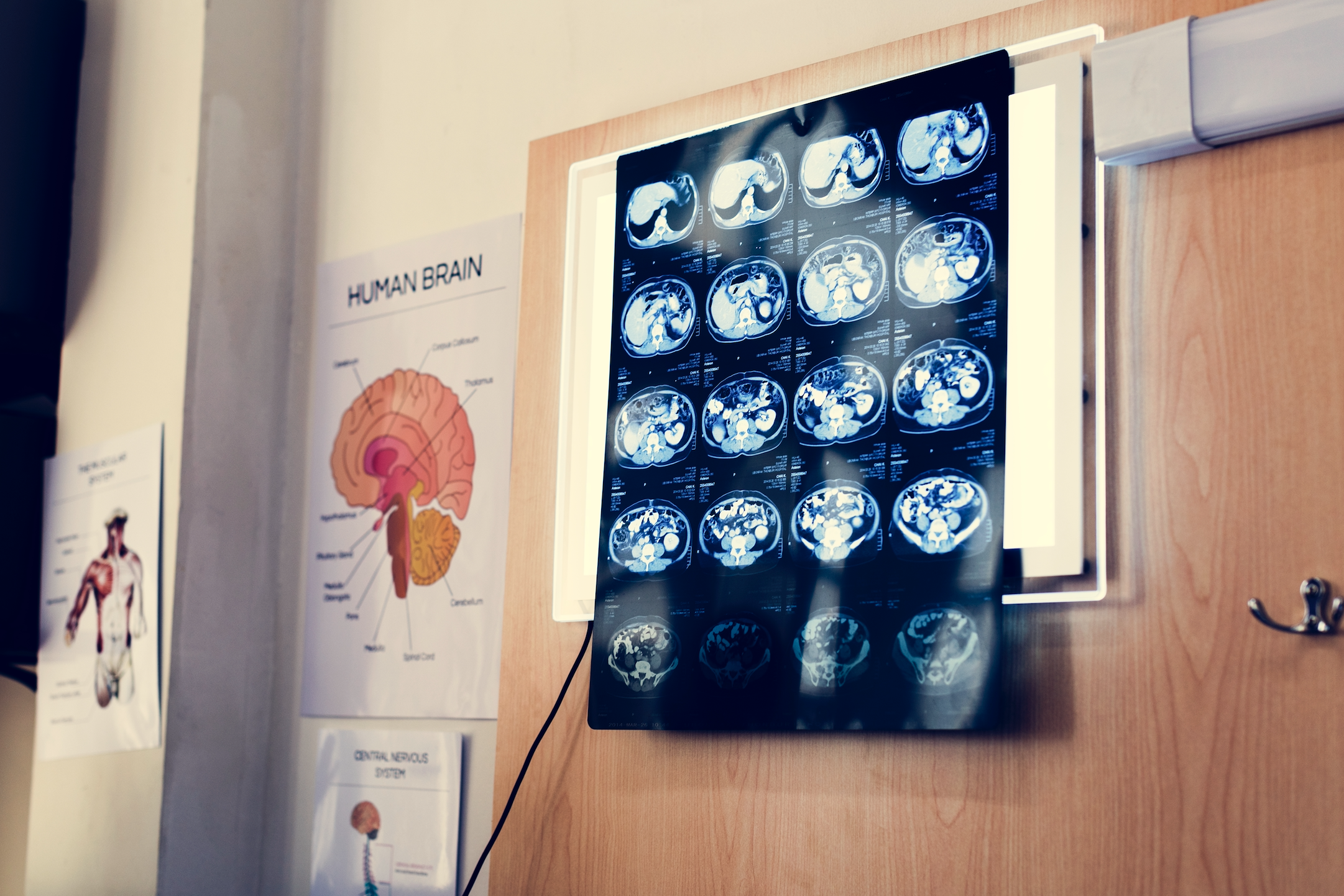 How One Amazing Woman Beat Crohn’s Disease And A Brain Tumour