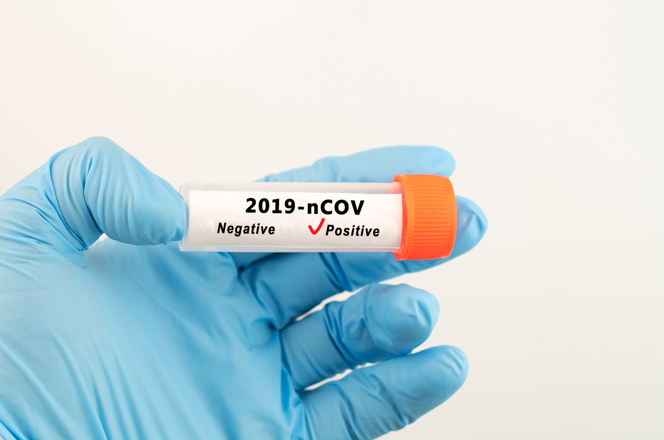 A 20-Year-Old Shares What It’s Like To Have COVID-19